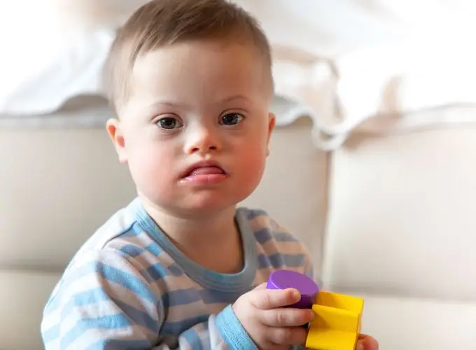 Down's syndrome - Perfect Balance Rehabilitation Centre Down's syndrome