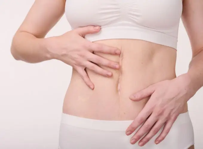 scar sensitivity - Perfect Balance Rehabilitation Centre scar sensitivity
