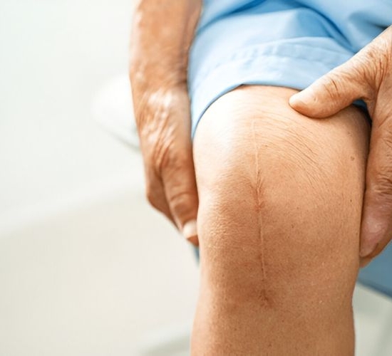 total-joint-replacement